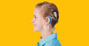 cochlear-implant-removebg-preview