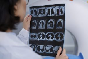 x ray image