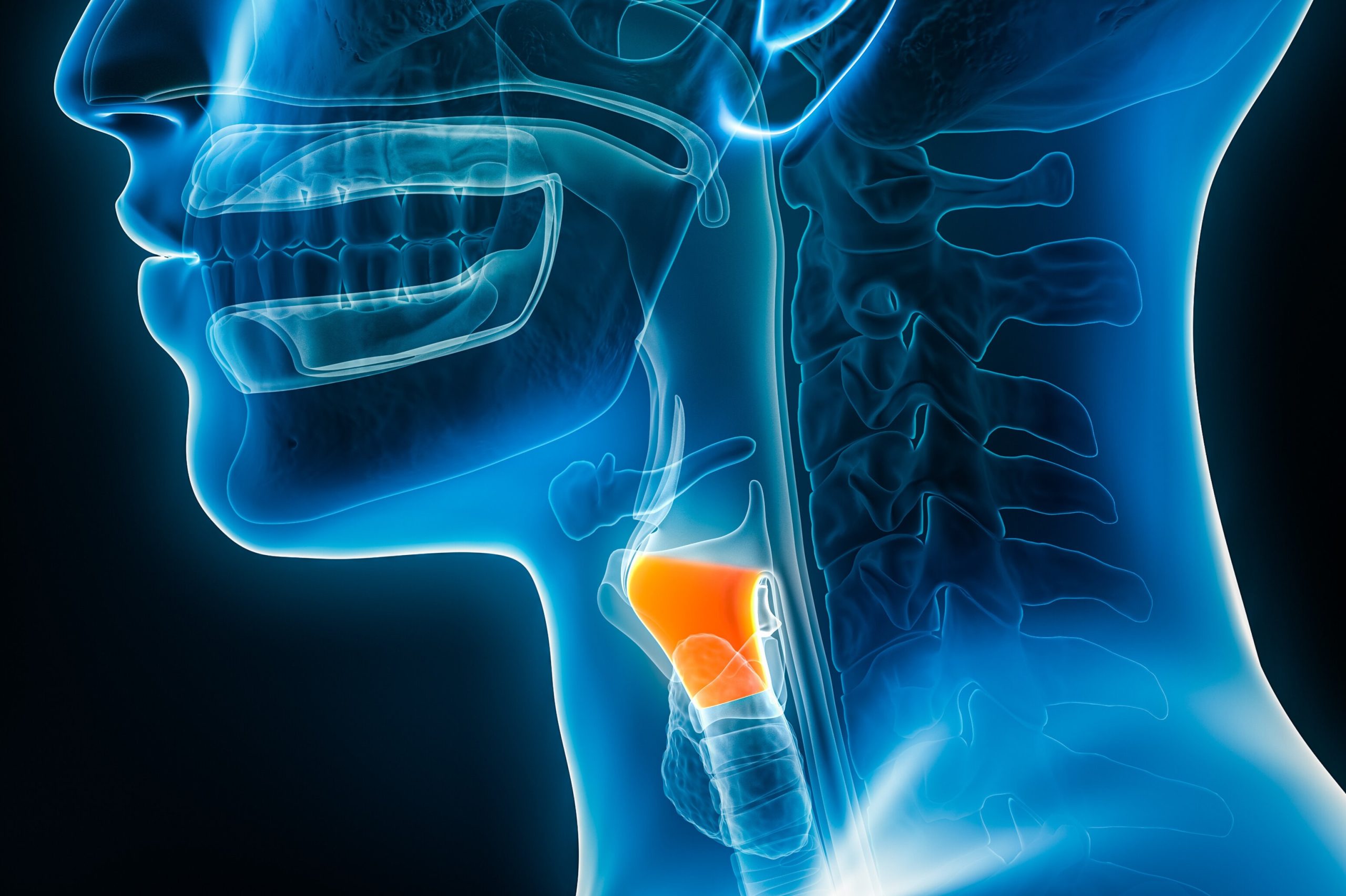 xray image
