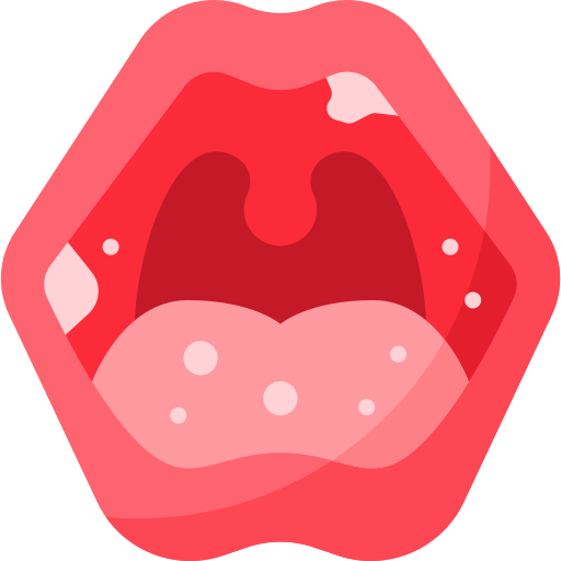 mouth-ulcer