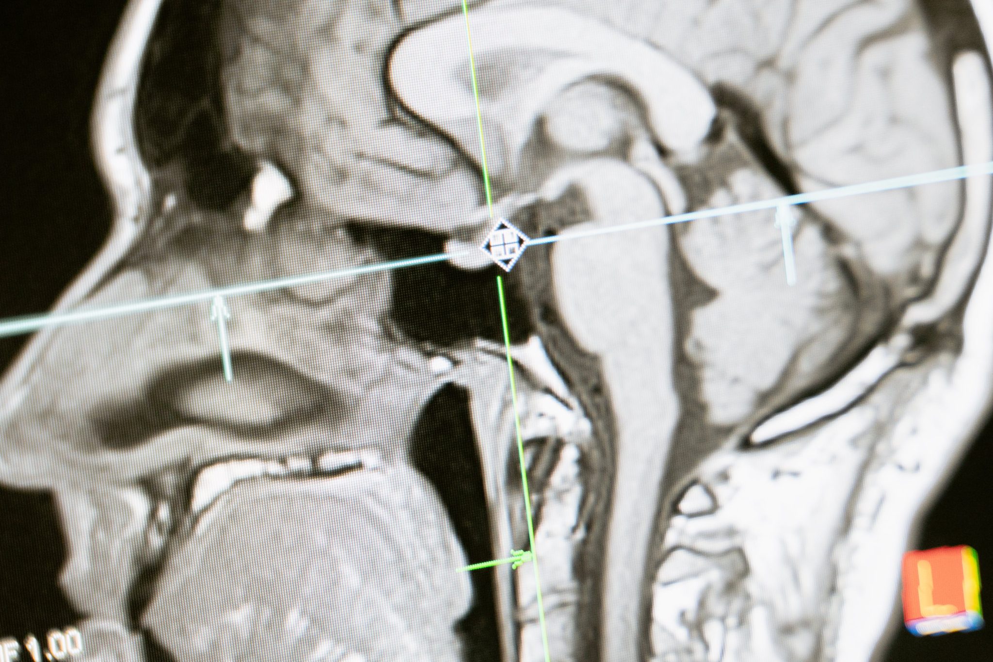 x ray image