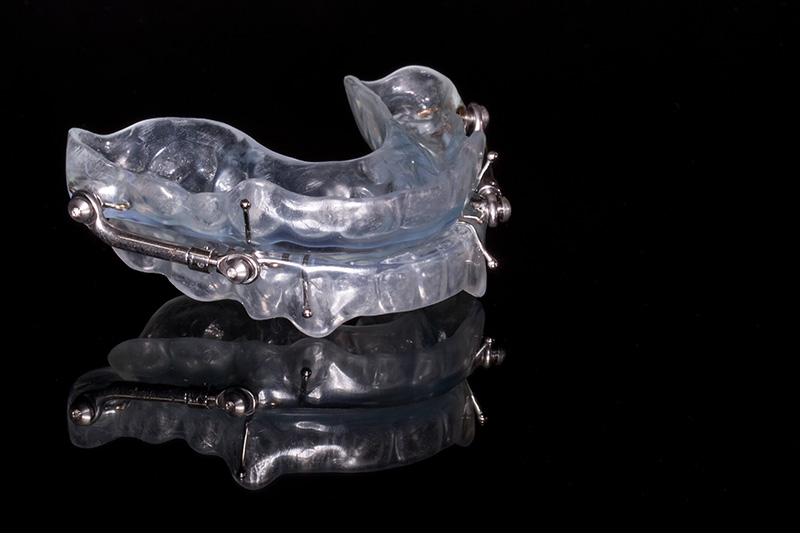 inliner for teeth